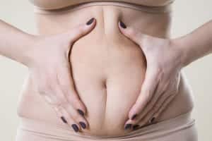 Woman holding fold of belly skin