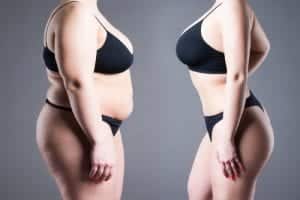 body before and after weight loss-img-blog