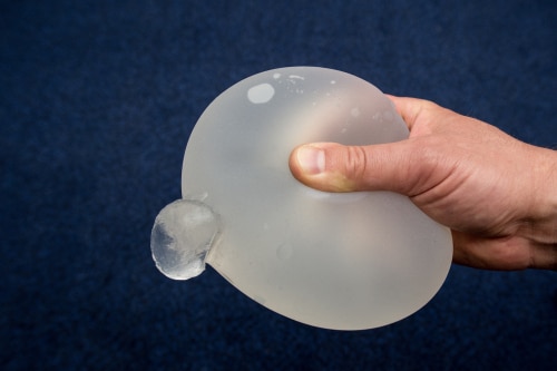 demonstration of the reliability of the breast implant-img-blog