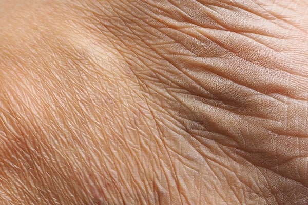 Up close view of wrinkles that can be treated with non-surgical options.