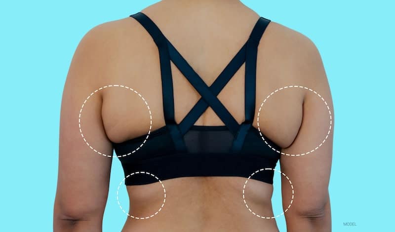 Back view of a woman in a sports bra with circles around bra rolls