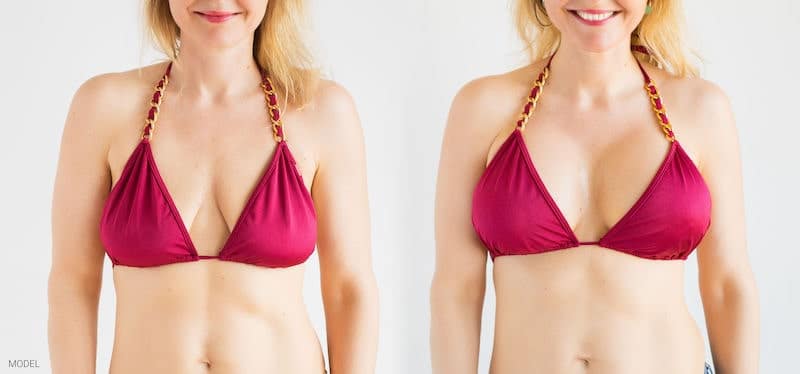 Why Not All Breast Procedures Are Only About Size - Premier Plastic Surgery